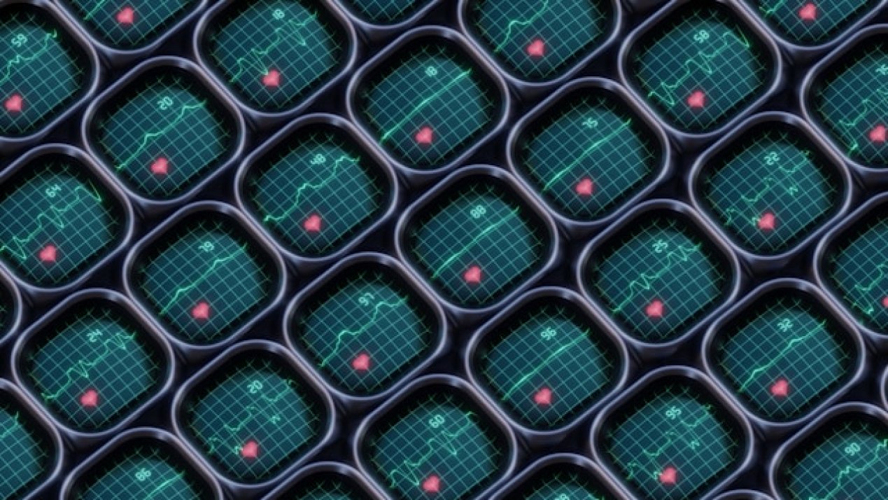 Avant, Ainnova Bring AI Diabetes Tech to Mexico