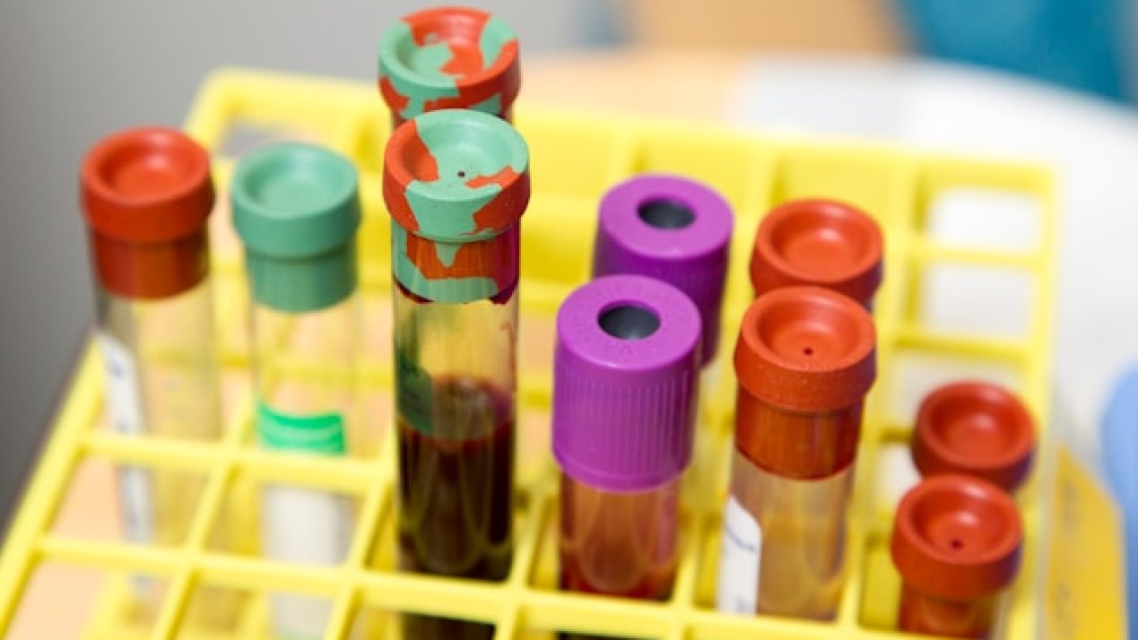 INCan Highlights Progress in Blood Cancer Therapies