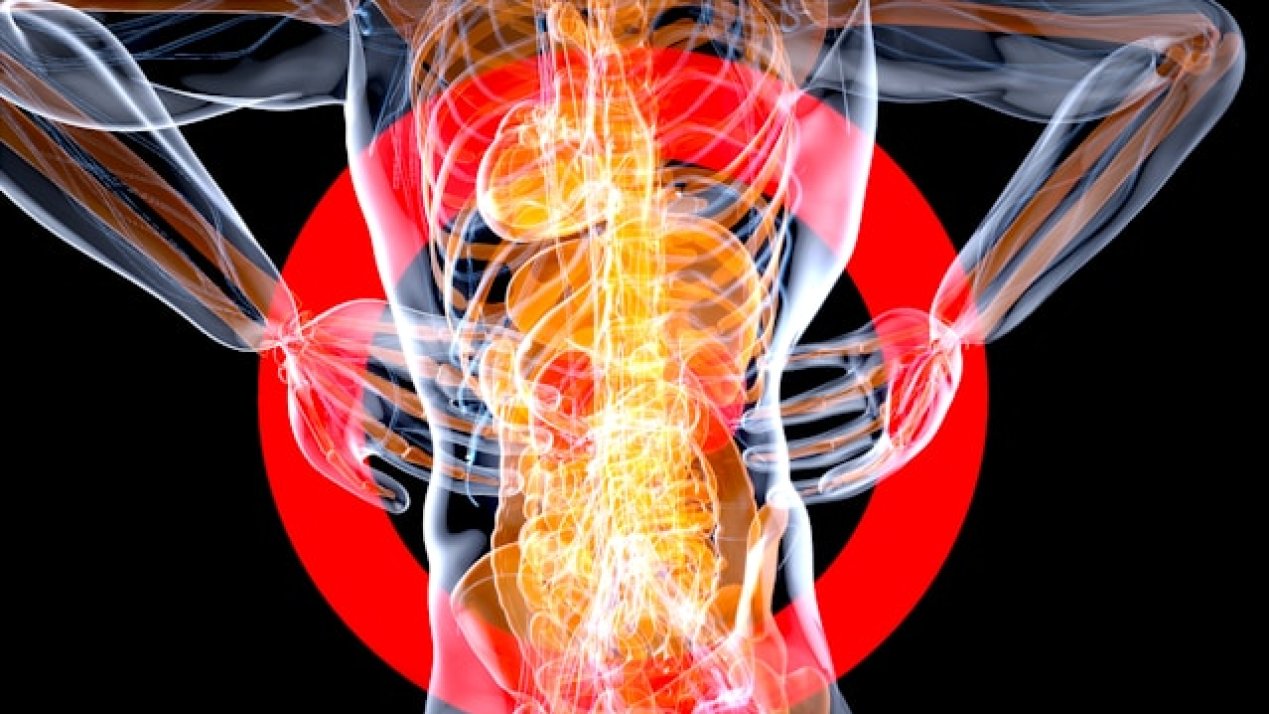 Rising Demand Spurs Spine Care Innovation in Mexico