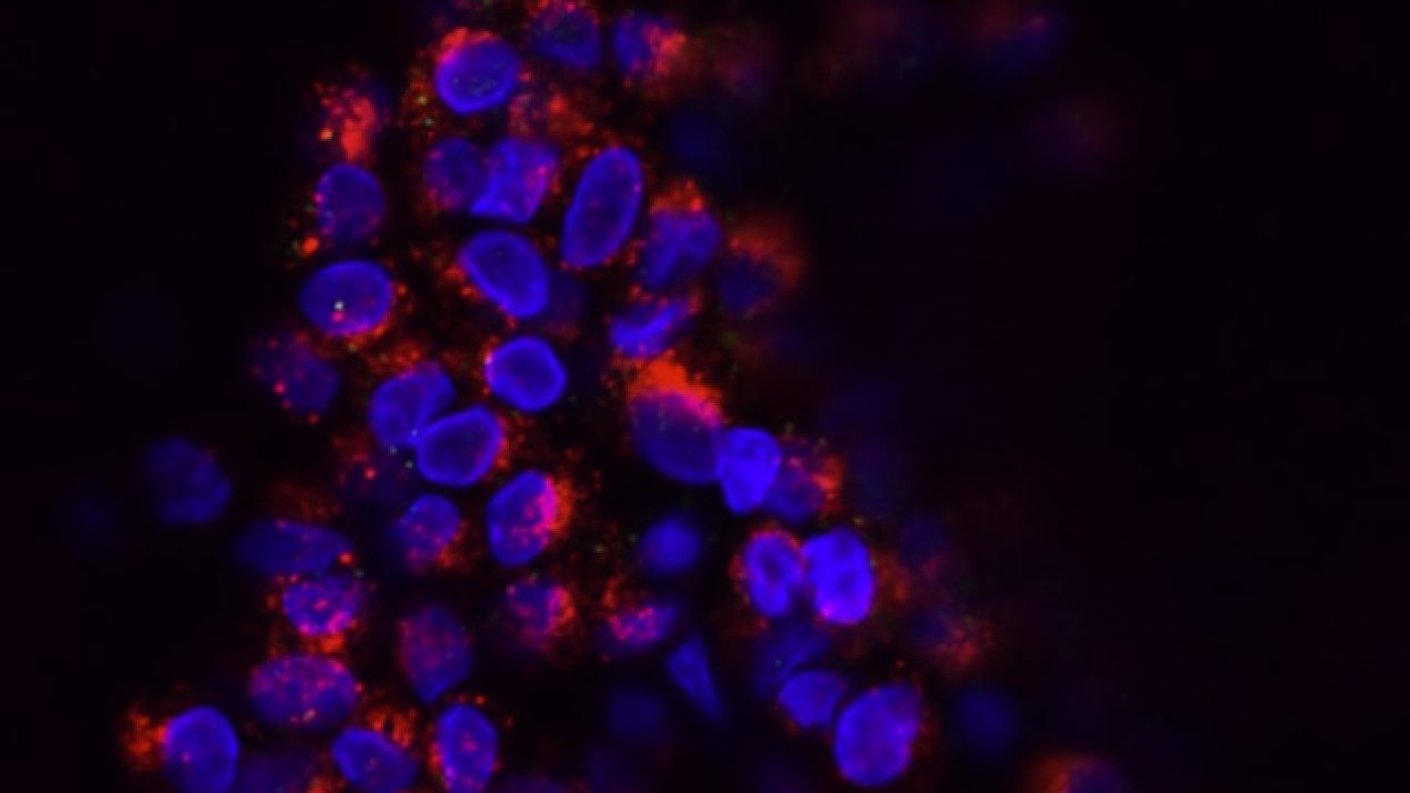 Mexico Joins Growing Market for Metastatic Cancer Therapeutics