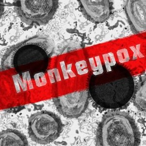 Philippines Reports First Mpox Case of 2024