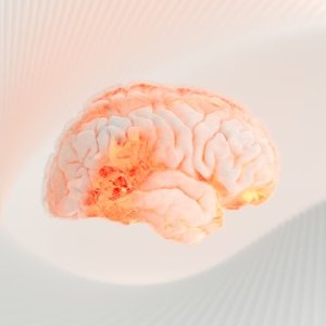 Early Diagnosis Key to Managing Multiple Sclerosis