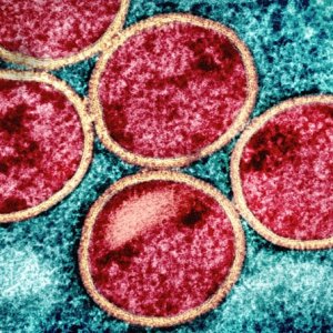 WHO Extends Mpox Emergency Status, Issues New Guidelines