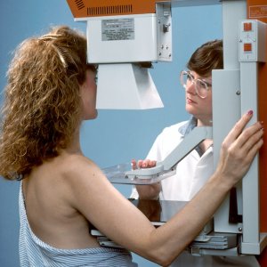 AI, 3D Imaging to Drive Mammography Market Growth Throughout 2030