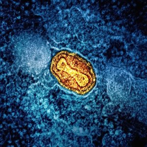 Mpox Cases Rise to 467 in Mexico; Mexico City Leads in Infections