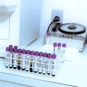 Genomma Lab Approved MX$200 Million Dividend for 4Q25