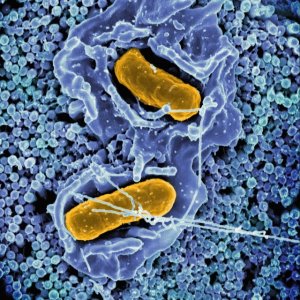 Hygiena Wins Global Awards for Dual-Pathogen PCR Test