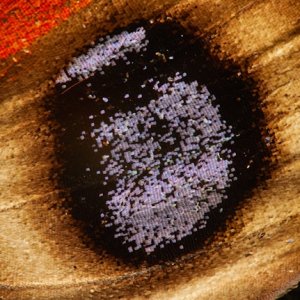 Trachoma at Risk Population Drops 94% Since 2002